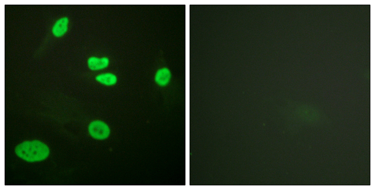 Histone H3 Antibody - Immunofluorescence analysis of HeLa cells, using Histone H3 (Acetyl-Lys9) Antibody. The picture on the right is blocked with the synthesized peptide.