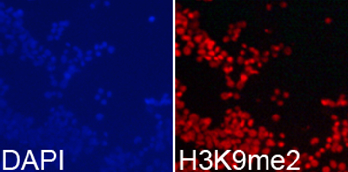 Histone H3 Antibody - Chromatin immunoprecipitation analysis extracts of 293 cells.
