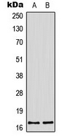 Histone H3 Antibody - Western blot analysis of Histone H3 expression in HeLa (A); A431 (B) whole cell lysates.