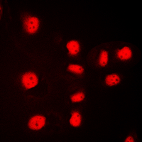 Histone H3 Antibody - Immunofluorescent analysis of Histone H3 staining in HeLa cells. Formalin-fixed cells were permeabilized with 0.1% Triton X-100 in TBS for 5-10 minutes and blocked with 3% BSA-PBS for 30 minutes at room temperature. Cells were probed with the primary antibody in 3% BSA-PBS and incubated overnight at 4 C in a humidified chamber. Cells were washed with PBST and incubated with a DyLight 594-conjugated secondary antibody (red) in PBS at room temperature in the dark. DAPI was used to stain the cell nuclei (blue).