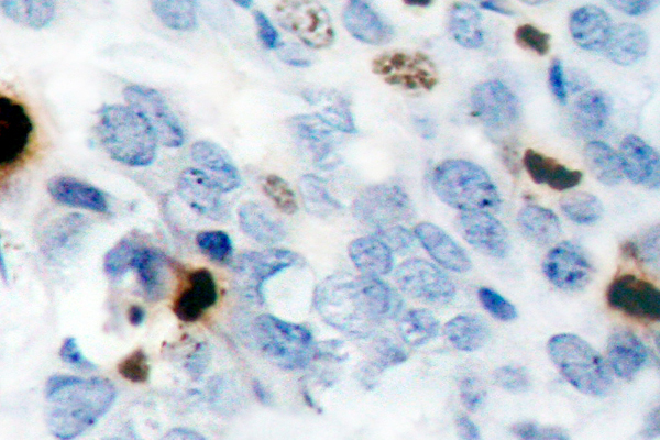 Histone H3 Antibody - IHC of p-Histone H3.1 (S10) pAb in paraffin-embedded human skeletal l muscle tissue.