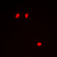 Histone H3 Antibody - Immunofluorescent analysis of Histone H3 (pS10) staining in Raw264.7 cells. Formalin-fixed cells were permeabilized with 0.1% Triton X-100 in TBS for 5-10 minutes and blocked with 3% BSA-PBS for 30 minutes at room temperature. Cells were probed with the primary antibody in 3% BSA-PBS and incubated overnight at 4 C in a humidified chamber. Cells were washed with PBST and incubated with a DyLight 594-conjugated secondary antibody (red) in PBS at room temperature in the dark. DAPI was used to stain the cell nuclei (blue).