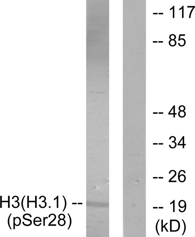 Histone H3 Antibody - Western blot analysis of lysates from HUVEC cells treated with Serum 20% 30', using Histone H3 (Phospho-Ser28) Antibody. The lane on the right is blocked with the phospho peptide.