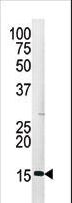 Histone H3 Antibody - Western blot of anti-Phospho-H3-pS28 antibody in HepG2 cell line lysate (35 ug/lane). Mouse Phospho-H3-pS28(arrow) was detected using the purified antibody.