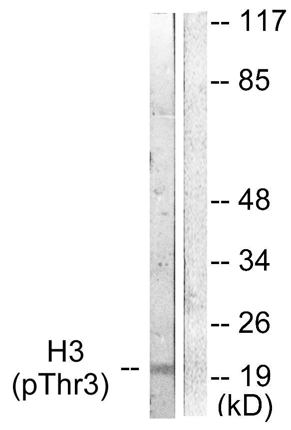 Histone H3 Antibody - Western blot analysis of lysates from HUVEC cells treated with Serum 20% 30', using Histone H3 (Phospho-Thr3) Antibody. The lane on the right is blocked with the phospho peptide.