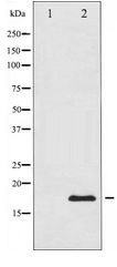 Histone H3.1 Antibody - Western blot of Histone H3.1 expression in COLO205 whole cell lysates,The lane on the left is treated with the antigen-specific peptide.