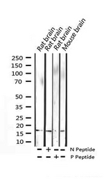 Histone H3.1 Antibody - Western blot analysis of Phospho-Histone H3.1 (Ser10) expression in various lysates
