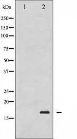 Histone H3.1 Antibody - Western blot analysis of Histone H3.1 phosphorylation expression in COLO205 whole cells lysates. The lane on the left is treated with the antigen-specific peptide.