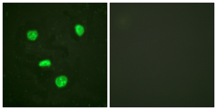 Histone H3.3 Antibody - Immunofluorescence analysis of HeLa cells, using Histone H3.3 Antibody. The picture on the right is blocked with the synthesized peptide.