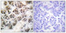 Histone H3.3 Antibody - Immunohistochemistry analysis of paraffin-embedded human brain, using Histone H3.3 Antibody. The picture on the right is blocked with the synthesized peptide.