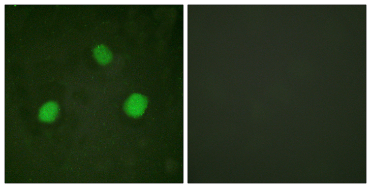 Histone H3.3 Antibody - Immunofluorescence analysis of HeLa cells, using Histone H3.3 (Phospho-Ser31) Antibody. The picture on the right is blocked with the phospho peptide.