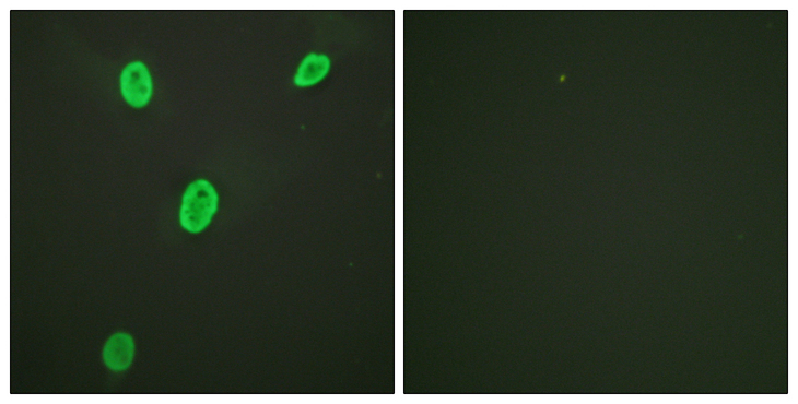 Histone H4 Antibody - Immunofluorescence analysis of HeLa cells, using Histone H4 (Acetyl-Lys12) Antibody. The picture on the right is blocked with the synthesized peptide.