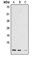 Histone H4 Antibody - Western blot analysis of Histone H4 (AcK12) expression in A431 (A); L929 (B); C6 (C) whole cell lysates.