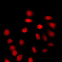 Histone H4 Antibody - Immunofluorescent analysis of Histone H4 (AcK12) staining in A431 cells. Formalin-fixed cells were permeabilized with 0.1% Triton X-100 in TBS for 5-10 minutes and blocked with 3% BSA-PBS for 30 minutes at room temperature. Cells were probed with the primary antibody in 3% BSA-PBS and incubated overnight at 4 C in a humidified chamber. Cells were washed with PBST and incubated with a DyLight 594-conjugated secondary antibody (red) in PBS at room temperature in the dark. DAPI was used to stain the cell nuclei (blue).