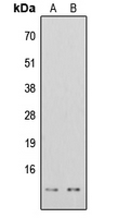 Histone H4 Antibody - Western blot analysis of Histone H4 (AcK16) expression in HeLa TSA-treated (A); HEK293T TSA-treated (B) whole cell lysates.