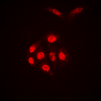 Histone H4 Antibody - Immunofluorescent analysis of Histone H4 (AcK16) staining in HEK293T cells. Formalin-fixed cells were permeabilized with 0.1% Triton X-100 in TBS for 5-10 minutes and blocked with 3% BSA-PBS for 30 minutes at room temperature. Cells were probed with the primary antibody in 3% BSA-PBS and incubated overnight at 4 deg C in a humidified chamber. Cells were washed with PBST and incubated with a DyLight 594-conjugated secondary antibody (red) in PBS at room temperature in the dark. DAPI was used to stain the cell nuclei (blue).
