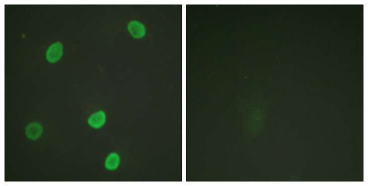 Histone H4 Antibody - Immunofluorescence analysis of HeLa cells, using Histone H4 (Acetyl-Lys8) Antibody. The picture on the right is blocked with the synthesized peptide.