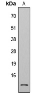 Histone H4 Antibody - Western blot analysis of Histone H4 (AcK8) expression in HeLa TSA-treated (A) whole cell lysates.