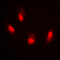 Histone H4 Antibody - Immunofluorescent analysis of Histone H4 (AcK8) staining in HeLa cells. Formalin-fixed cells were permeabilized with 0.1% Triton X-100 in TBS for 5-10 minutes and blocked with 3% BSA-PBS for 30 minutes at room temperature. Cells were probed with the primary antibody in 3% BSA-PBS and incubated overnight at 4 deg C in a humidified chamber. Cells were washed with PBST and incubated with a DyLight 594-conjugated secondary antibody (red) in PBS at room temperature in the dark. DAPI was used to stain the cell nuclei (blue).