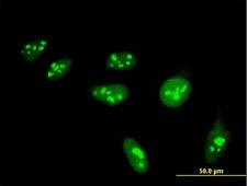 Histone H4 Antibody - Immunofluorescence of monoclonal antibody to HIST1H4H on HeLa cell . [antibody concentration 10 ug/ml]