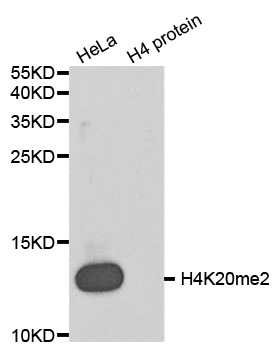 Histone H4 Antibody - Western blot analysis of extracts of HeLa cells and H4 protein expressed in E.coli.