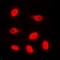 Histone H4 Antibody - Immunofluorescent analysis of Histone H4 staining in HeLa cells. Formalin-fixed cells were permeabilized with 0.1% Triton X-100 in TBS for 5-10 minutes and blocked with 3% BSA-PBS for 30 minutes at room temperature. Cells were probed with the primary antibody in 3% BSA-PBS and incubated overnight at 4 C in a humidified chamber. Cells were washed with PBST and incubated with a DyLight 594-conjugated secondary antibody (red) in PBS at room temperature in the dark. DAPI was used to stain the cell nuclei (blue).