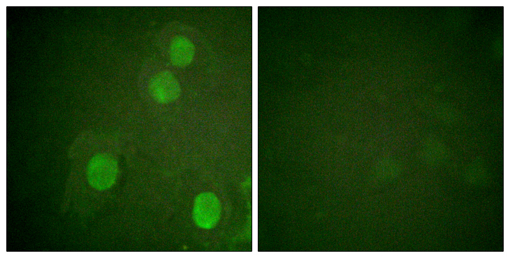 Histone H4 Antibody - Immunofluorescence analysis of HUVEC cells, using Histone H4 (Phospho-Ser47) Antibody. The picture on the right is blocked with the phospho peptide.