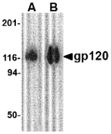 HIV-1 gp120 Antibody - Western blot of 1 mg of gp120 with gp120 antibody at (A) 0.5 and (B) 1 ug/ml.