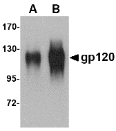 HIV-1 gp120 Antibody - Western blot of (A) 25 and (B) 100 ng of gp120 with gp120 antibody at 1 ug/ml.