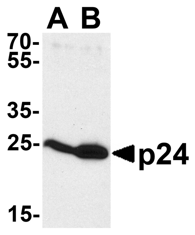 HIV-1 p24 Antibody - Western blot analysis of p24 using p24 antibody at 0.5 ug/ml to detect (A) 2 ng and (B) 10 ng of recombinant HIV-1 p24.