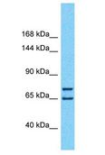 HIVEP1 / MBP-1 Antibody - HIVEP1 / MBP-1 antibody Western Blot of HepG2. Antibody dilution: 1 ug/ml.  This image was taken for the unconjugated form of this product. Other forms have not been tested.