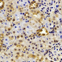 HIWI2 / PIWIL4 Antibody - Immunohistochemical analysis of HIWI2 staining in rat kidney formalin fixed paraffin embedded tissue section. The section was pre-treated using heat mediated antigen retrieval with sodium citrate buffer (pH 6.0). The section was then incubated with the antibody at room temperature and detected using an HRP conjugated compact polymer system. DAB was used as the chromogen. The section was then counterstained with hematoxylin and mounted with DPX.