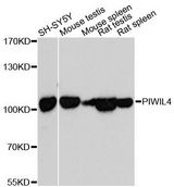 HIWI2 / PIWIL4 Antibody - Western blot analysis of extracts of various cell lines, using PIWIL4 antibody at 1:3000 dilution. The secondary antibody used was an HRP Goat Anti-Rabbit IgG (H+L) at 1:10000 dilution. Lysates were loaded 25ug per lane and 3% nonfat dry milk in TBST was used for blocking. An ECL Kit was used for detection and the exposure time was 90s.