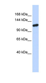 HIWI2 / PIWIL4 Antibody - PIWIL4 antibody Western blot of Fetal Brain lysate. This image was taken for the unconjugated form of this product. Other forms have not been tested.