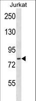 HJURP Antibody - HJURP Antibody western blot of Jurkat cell line lysates (35 ug/lane). The HJURP antibody detected the HJURP protein (arrow).