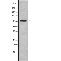 HJURP Antibody - Western blot analysis of HJURP using COLO205 whole cells lysates