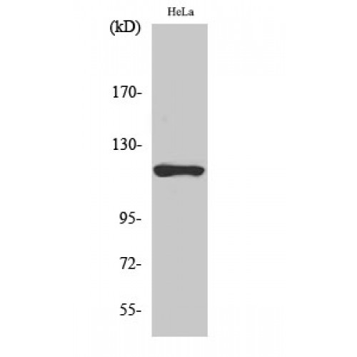 HK1 / Hexokinase 1 Antibody - Western blot of HXK I antibody