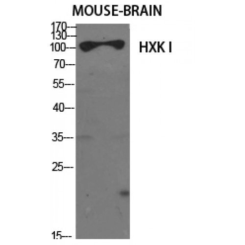 HK1 / Hexokinase 1 Antibody - Western blot of HXK I antibody