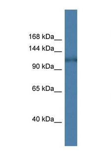 HK1 / Hexokinase 1 Antibody - HK1 / Hexokinase 1 antibody Western blot of Fetal Heart lysate. Antibody concentration 1 ug/ml.  This image was taken for the unconjugated form of this product. Other forms have not been tested.