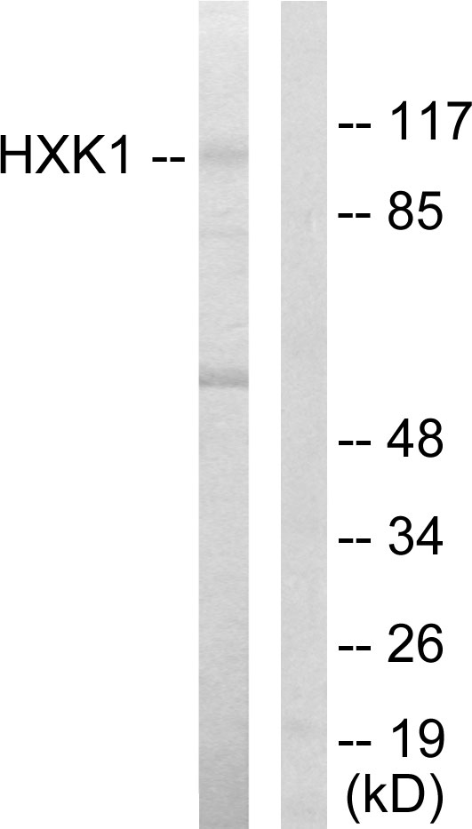 HK1 / Hexokinase 1 Antibody - Western blot analysis of lysates from HeLa cells, using HXK1 Antibody. The lane on the right is blocked with the synthesized peptide.
