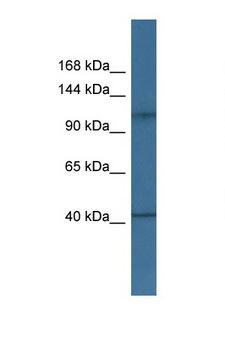 HK1 / Hexokinase 1 Antibody - HK1 / Hexokinase 1 antibody Western blot of Fetal Heart lysate. Antibody concentration 1 ug/ml.  This image was taken for the unconjugated form of this product. Other forms have not been tested.