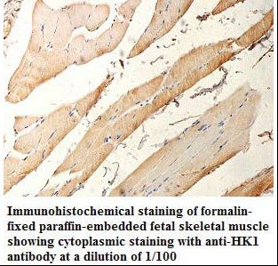 HK1 / Hexokinase 1 Antibody