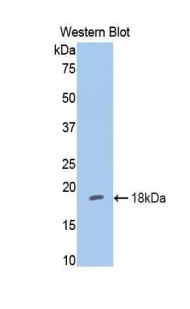 HK1 / Hexokinase 1 Antibody - Western blot of recombinant HK1 / Hexokinase 1.  This image was taken for the unconjugated form of this product. Other forms have not been tested.