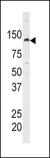 HK1 / Hexokinase 1 Antibody - Western blot of anti-HK1 Antibody in A375 cell line lysate. HK1(arrow) was detected using the purified antibody.