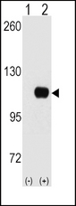 HK1 / Hexokinase 1 Antibody - Western blot of HK1 (arrow) using HK1 Antibody. 293 cell lysates (2 ug/lane) either nontransfected (Lane 1) or transiently transfected with the HK1 gene (Lane 2) (Origene Technologies).