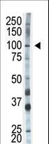 HK1 / Hexokinase 1 Antibody - The anti-HK1 antibody is used in Western blot to detect HK1 in mouse skeletal muscle tissue lysate.