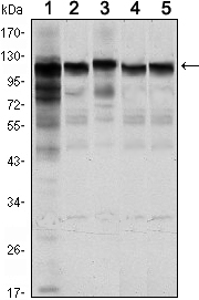 HK1 / Hexokinase 1 Antibody - Western blot using HK1 mouse monoclonal antibody against Jurkat (1), HeLa (2), HepG2 (3), MCF-7 (4) and PC-12 (5) cell lysate.