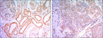 HK1 / Hexokinase 1 Antibody - IHC of paraffin-embedded human salivary gland tissues (left) and kidney tissues (right) using HK1 mouse monoclonal antibody with DAB staining.