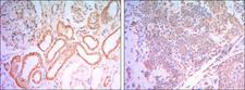 HK1 / Hexokinase 1 Antibody - IHC of paraffin-embedded human salivary gland tissues (left) and kidney tissues (right) using HK1 mouse monoclonal antibody with DAB staining.