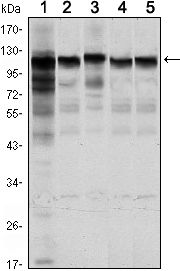 HK1 / Hexokinase 1 Antibody - HK1 Antibody in Western Blot (WB)
